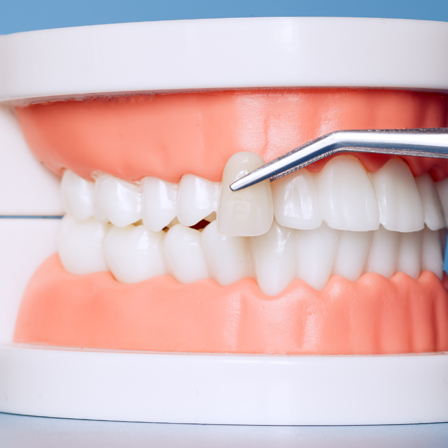Ästhetik und Zahnerhaltung