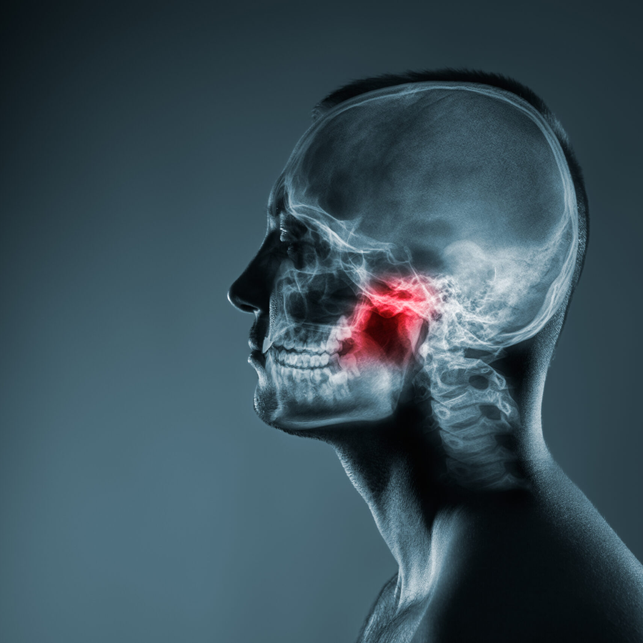 3D-Röntgendiagnostik zur Implantatplanung in Lippstadt 3D-Röntgendiagnostik zur Implantatplanung in Lippstadt